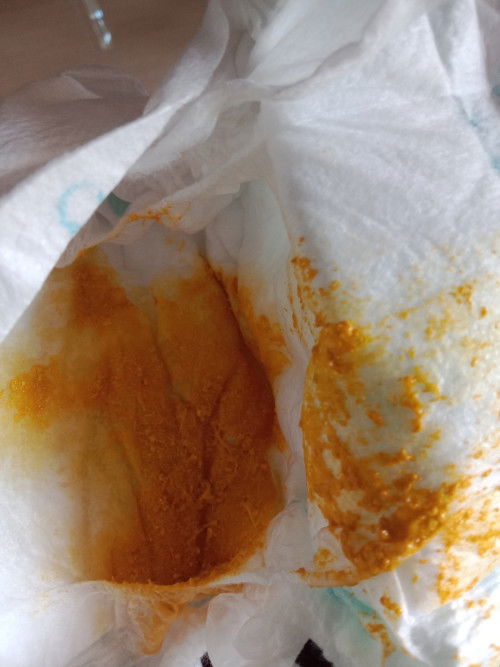 Full asi apakah bisa diare?