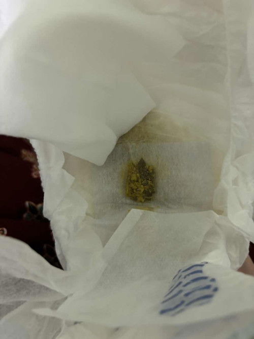 สีอึแบบนี้ปกติมั้ยค่ะ