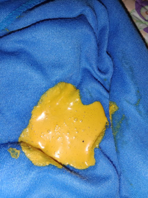 Bun bayi ku sufor pup bayi 2 bulan begini,apa ini diaree yaa?