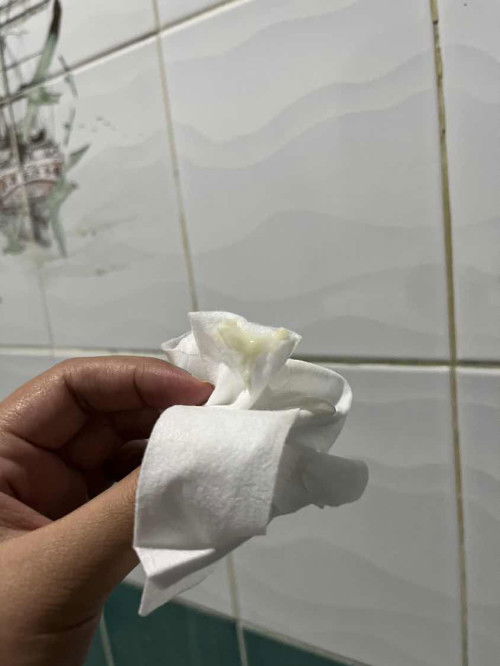 ตั้งครรภ์ 34W 3D มีมูกขุ่นคืออะไีร