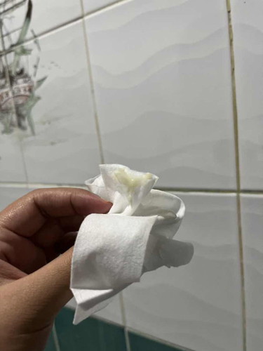 ตั้งครรภ์ 34W 3D มีมูกขุ่นคืออะไีร