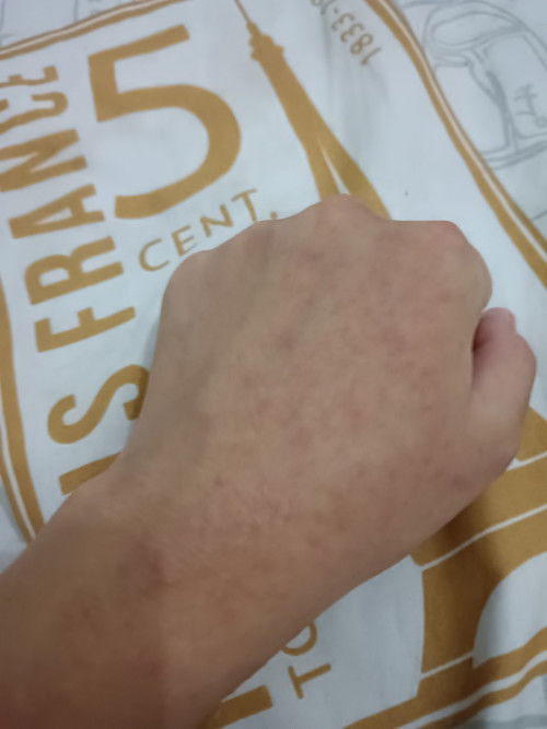 Biang keringat ibu hamil