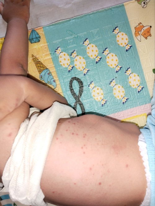 Bintik bintik merah berair