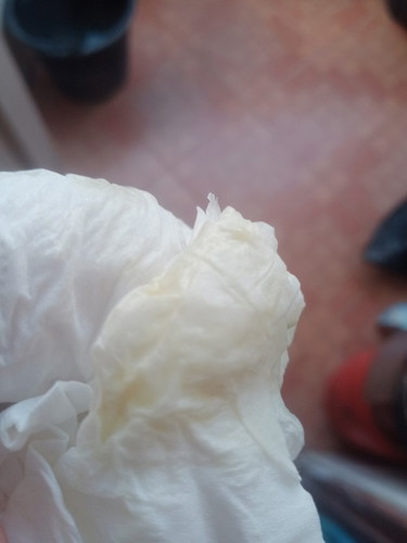 ถ้ามีมูกออกสีตาลเป็นไรไหมค่ะ39+1แล้วค่ะ