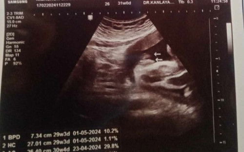 เเม่ๆช่วยดูหน่อยจ้า