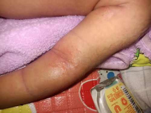 Bunda siapa tau disini ada yg tau ini kenapa ya hampir di seluruh badan kek gini,obat nya pake apa?