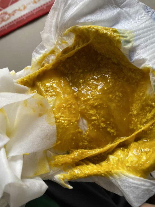 najis anak berlendir