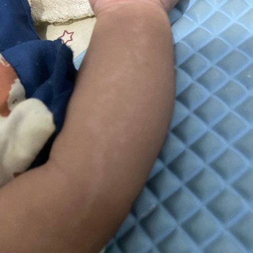 Kulit bayi
