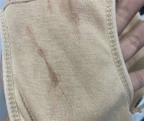 Flek bgini bahaya gk ya bun🥺