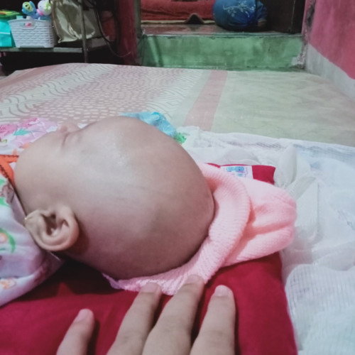 Kepala bayi
