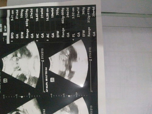 Aku lupa penjelasan Dokternya.. ada yang bisa jelasin gak ? berat janinnya berapa ya ?