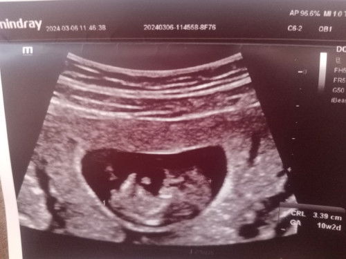 แม่ๆคนไหนดูรูปออกมั้ยคะ