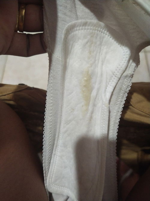 Vaginal discharge during my preganancy