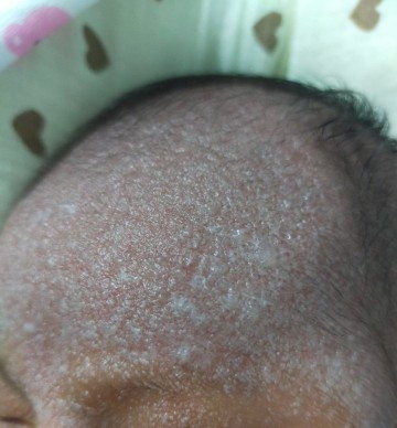 ลูกอายุ 6 วัน