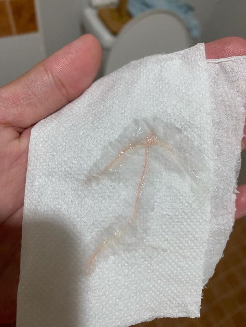 เเม่ๆ คะ  พอดีเข้าห้องนำ้เเล้ว  มีเมือกสีขาวใสผสม กับเลือดมาหน่อยๆค่ะ  เเล้ววันนี้หมอนัดพอดีด้วย37+5ค่ะ