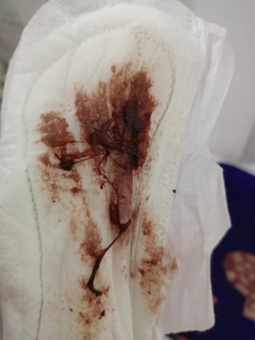 keluar darah setelah hb