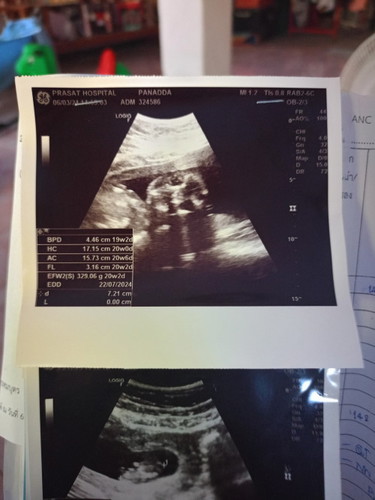 ช่วยดูเพศลูกหน่อยคะ