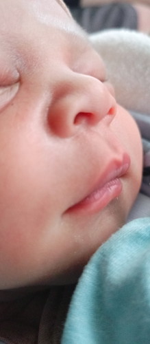 Lahir 39 week, HPL 13 MARET