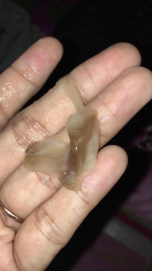 Lendir seperti ingus