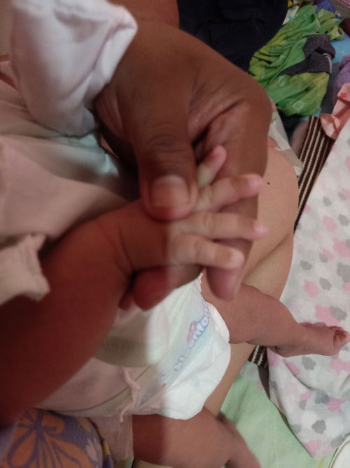 Nangingitim na dulo ng daliri ni baby