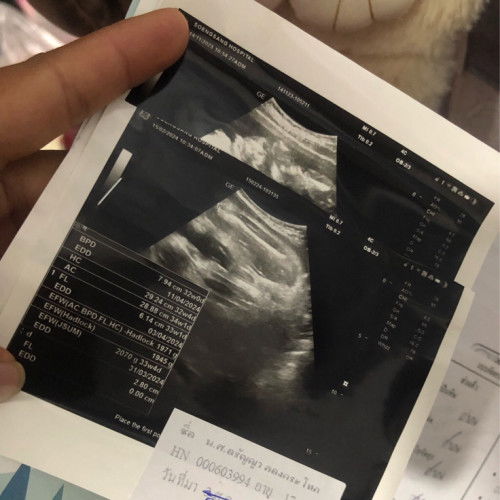 34วีค อวัยวะนี้คืออวัยวะใดคะ