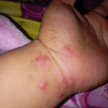 Gatel Misi bunda ada yang mengalami seperti difoto gak ya??