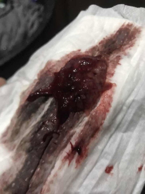 dugo or placenta poba ito? kasi buong month ng feb. hindi po ako magkameron possible poba?