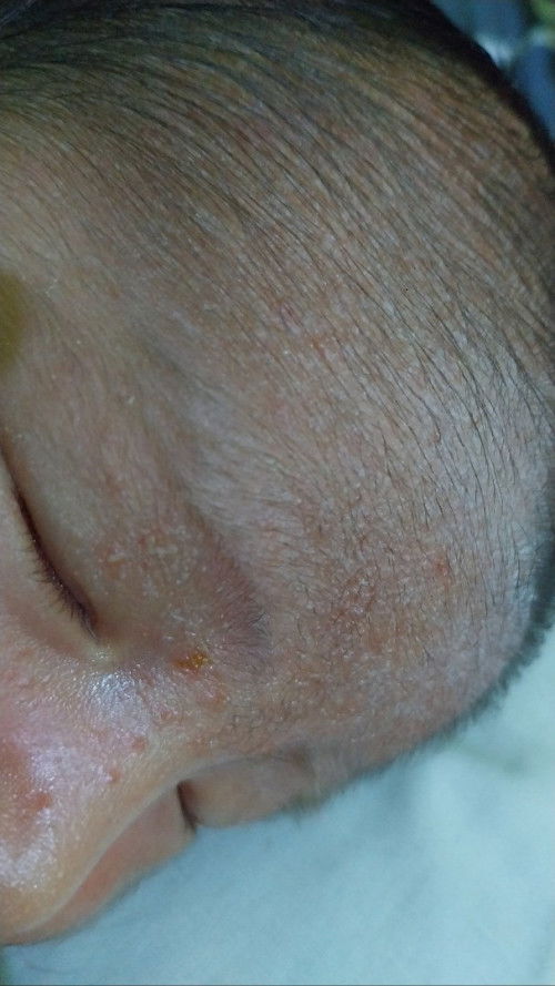 Bun bantu jawab di kasih apa ya biar cepat ilang.