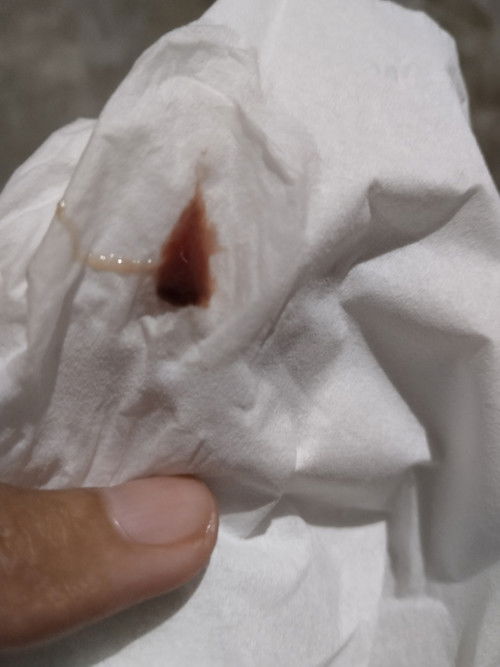 Flek di usia 6minggu