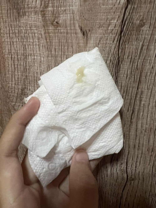 ตกขาวสีแบบนี้อันตรายมั้ยคะ