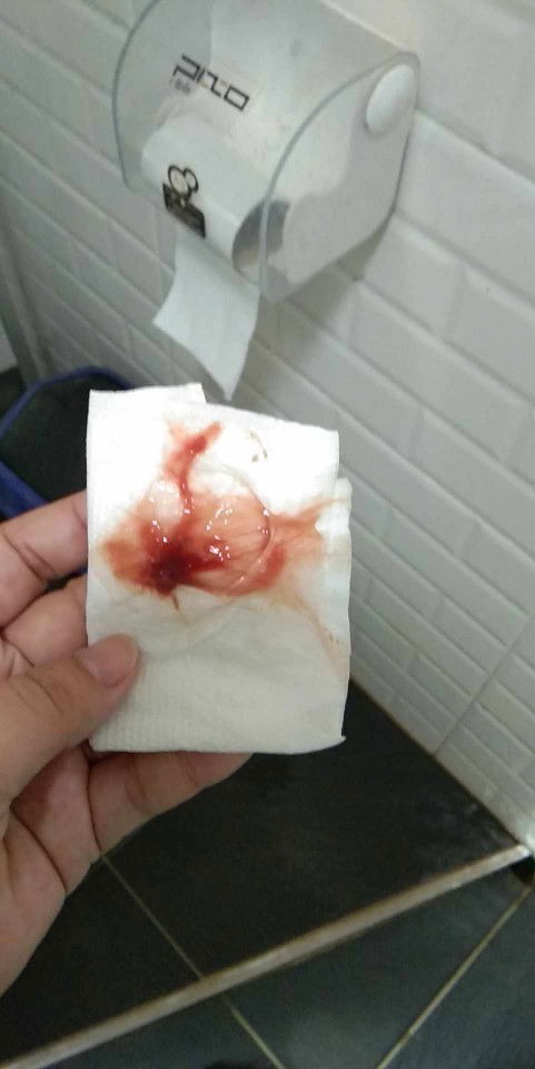 ตั้งครรภ์38w2d