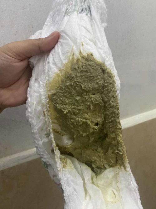 Mau Tanya bun maaf kalo jorok