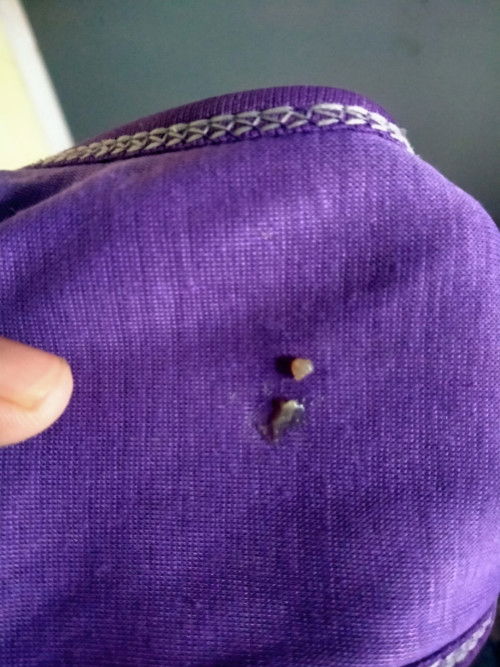 Maaf jorok Bun ini keputihan atau apa ya?