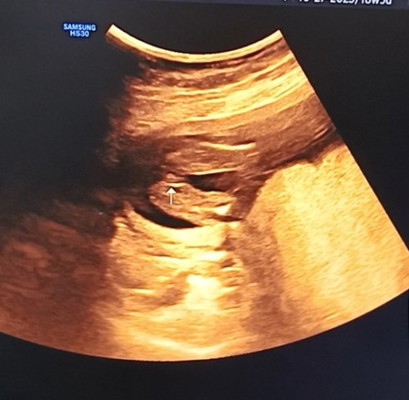Is it a boy or girl?
