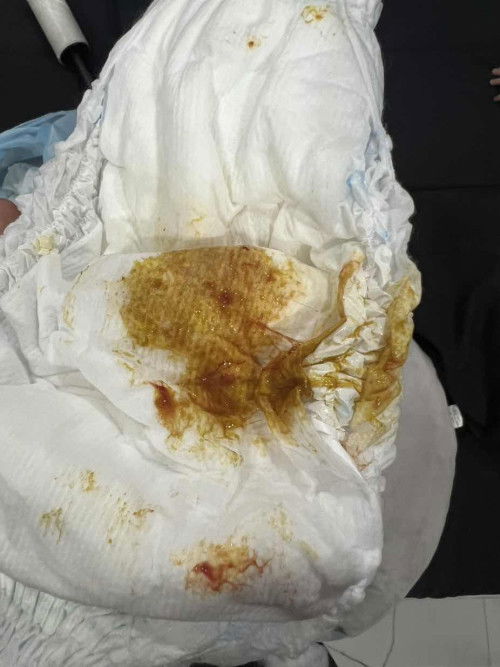 ถ่ายเป็นเลือด!