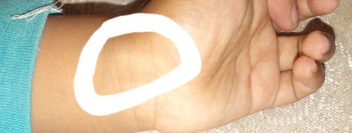 Ada benjolan di pergelangan tamgan seperti tulang