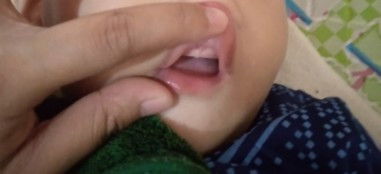 Anak 1 tahun belum tumbuh gigi apakah aman??