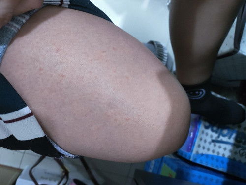 May nagkaganito po ba dito ?