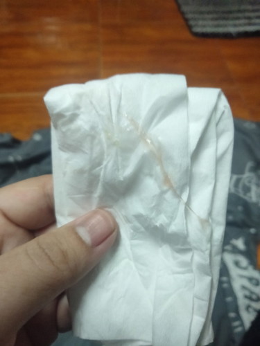 แบบนี้คือมูกเลือดไหมคะ