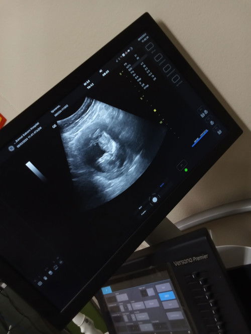 อยากถามเเม่ๆรีคนที่มีความรู้ค่ะ