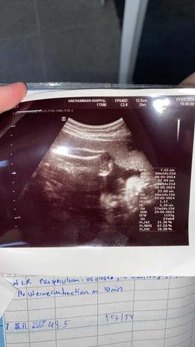 สอบถามเเม่เเม่ค่ะ