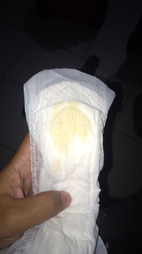 usia kandungan 37week 5day keluar cairan gini knp ya bun ?