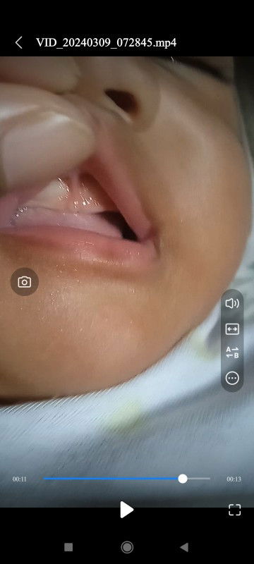 Adakah bayi bunda yg tidak mau menyusu karena mulutnya ada sakit?