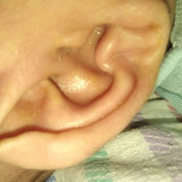 Assalamualaikum, telinga bayi 2 bulan kadang berair dan bau knpa ya bun, tp cuma sebelah kanan