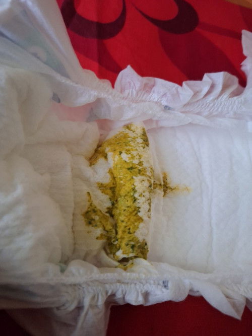 Bab bayi kuning ada hijau