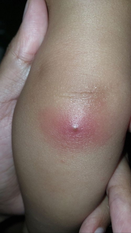 Halo bunda. Izin bertanya ini apa ya bun ?