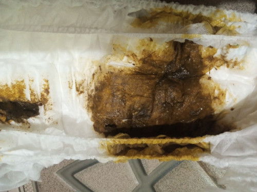 Mengenai pup anak umur 1,5 bulan