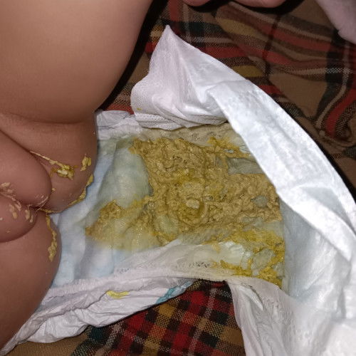 Color ng poop ni baby