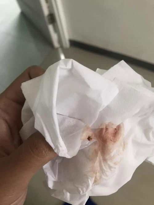 flek cokelat usia kehamilan 6minggu