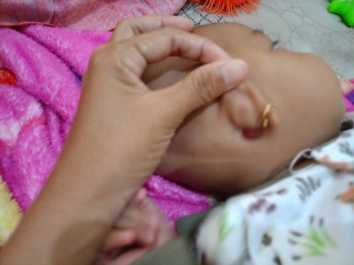 Haloo Bun, apakah ini bahaya ?